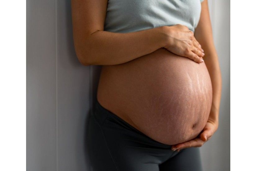 Cmo prevenir las estras durante el embarazo: consejos y productos recomendados