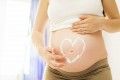 Los mejores productos hidratantes para la piel de mujeres embarazadas: reseas y recomendaciones